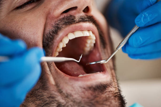Best Emergency Dentist for Lost Fillings or Crowns in Stromsburg, NE